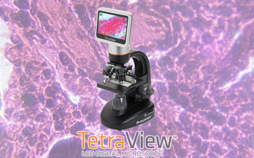 TetraView LCD デジタル顕微鏡